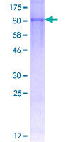 12.5% SDS-PAGE Stained with Coomassie Blue
